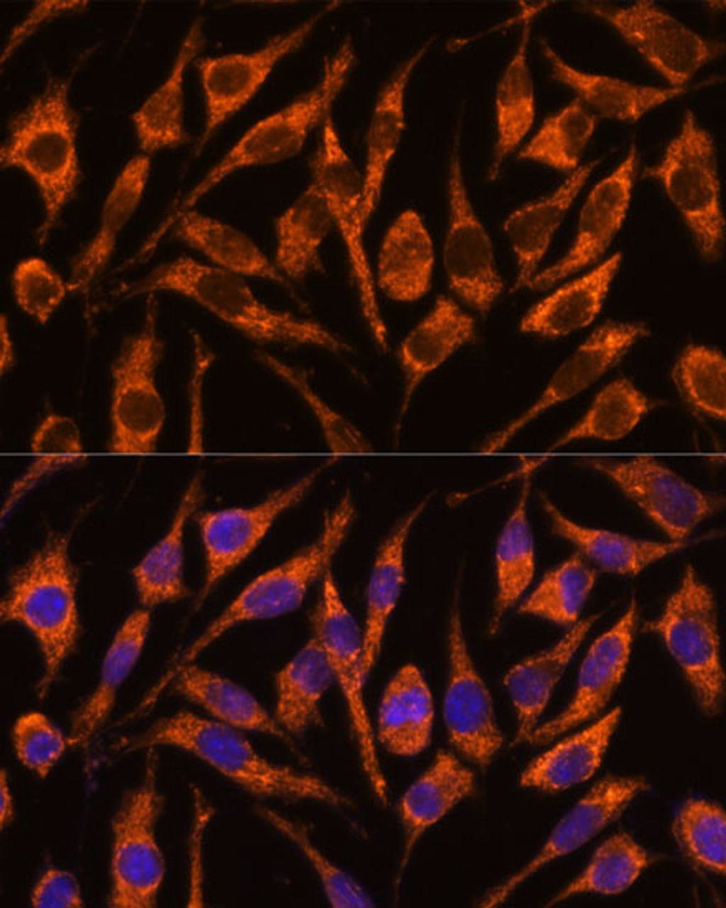 Immunofluorescence analysis of L929 cells using SNX15 Polyclonal Antibody at dilution of  1:100. Blue: DAPI for nuclear staining.