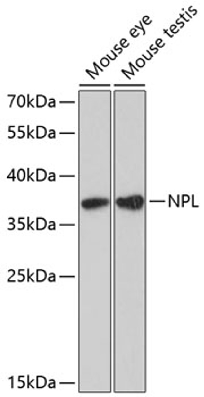 Western blot analysis of extracts of various cell lines using NPL Polyclonal Antibody at dilution of 1:3000.