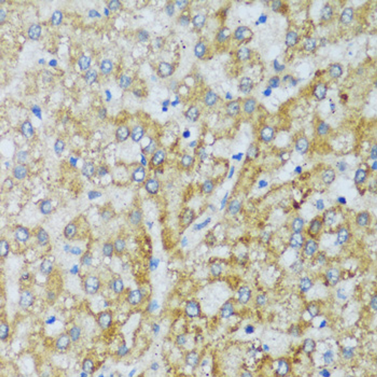 Immunohistochemistry of paraffin-embedded Human liver using C1QC Polyclonal Antibody at dilution of  1:100 (40x lens).