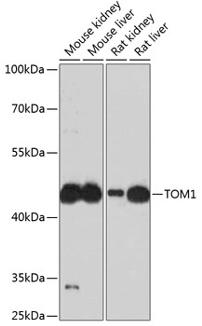 Western blot analysis of extracts of various cell lines using TOM1 Polyclonal Antibody at dilution of 1:3000.