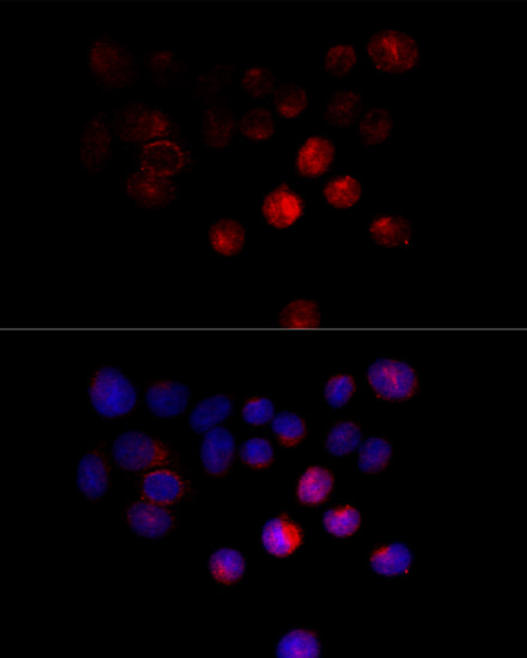 Immunofluorescence analysis of 293T cells using TOM1 Polyclonal Antibody at dilution of  1:100 (40x lens). Blue: DAPI for nuclear staining.