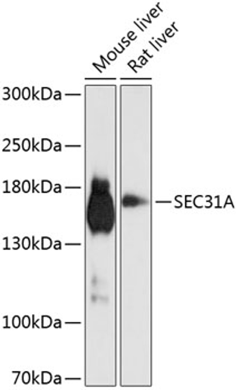 Western blot analysis of extracts of various cell lines using SEC31A Polyclonal Antibody at dilution of 1:1000.