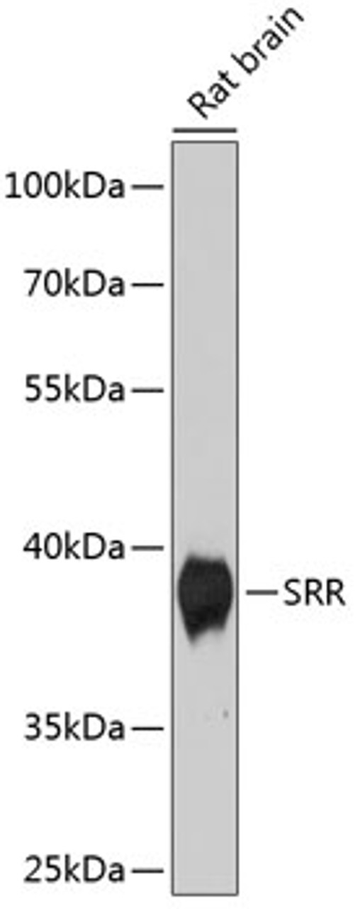 Western blot analysis of extracts of Rat brain using SRR Polyclonal Antibody at dilution of 1:1000.