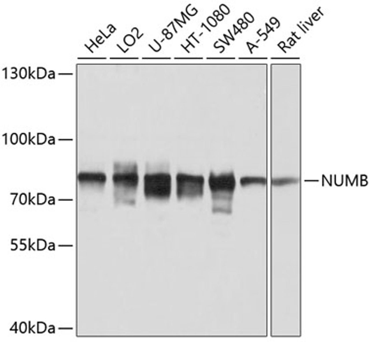 Western blot analysis of extracts of various cell lines using NUMB Polyclonal Antibody at dilution of 1:1000.
