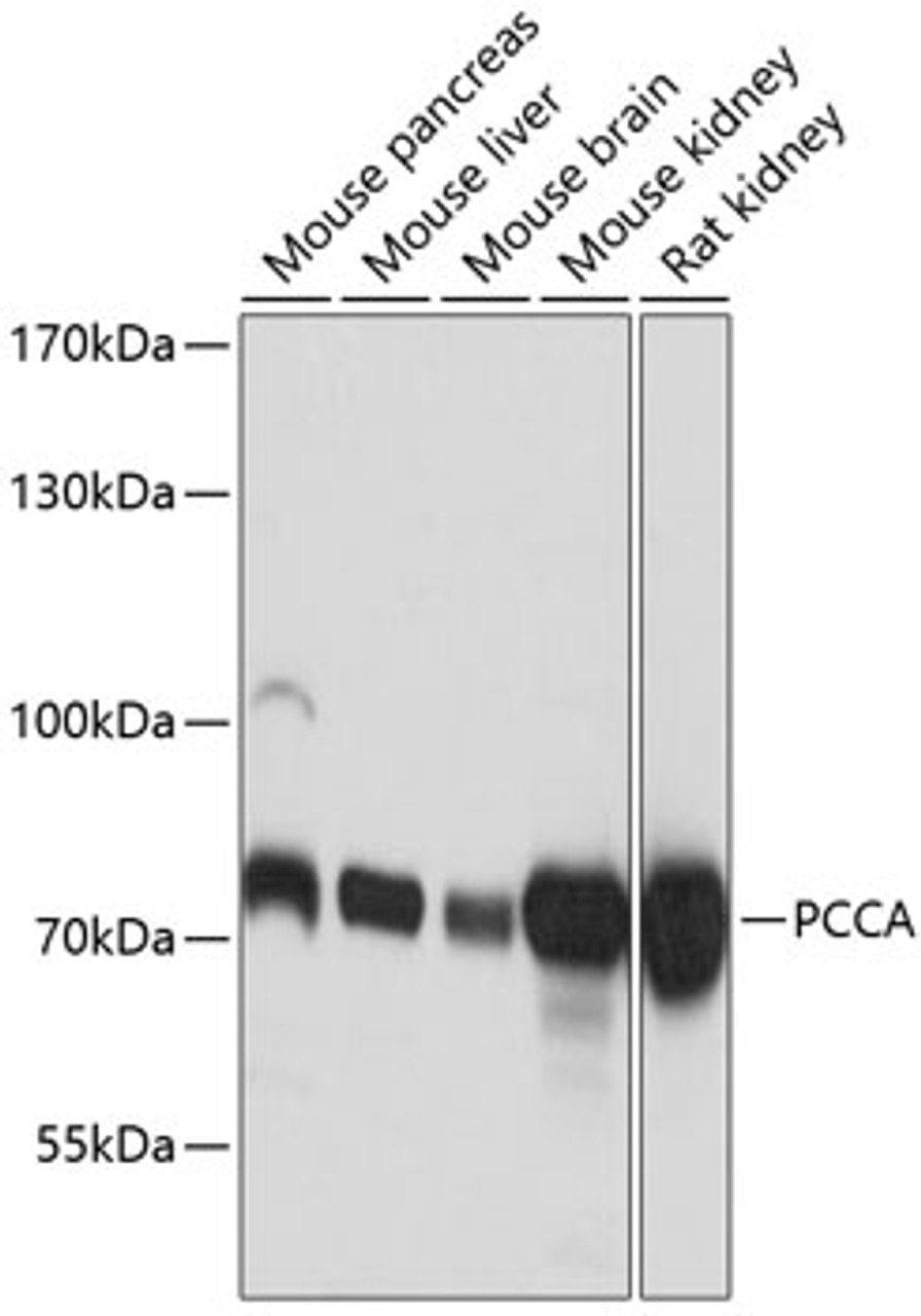 Western blot analysis of extracts of various cell lines using PCCA Polyclonal Antibody at dilution of 1:3000.