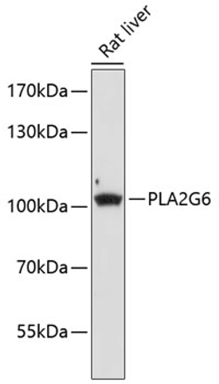 Western blot analysis of extracts of Rat liver using PLA2G6 Polyclonal Antibody at dilution of 1:1000.