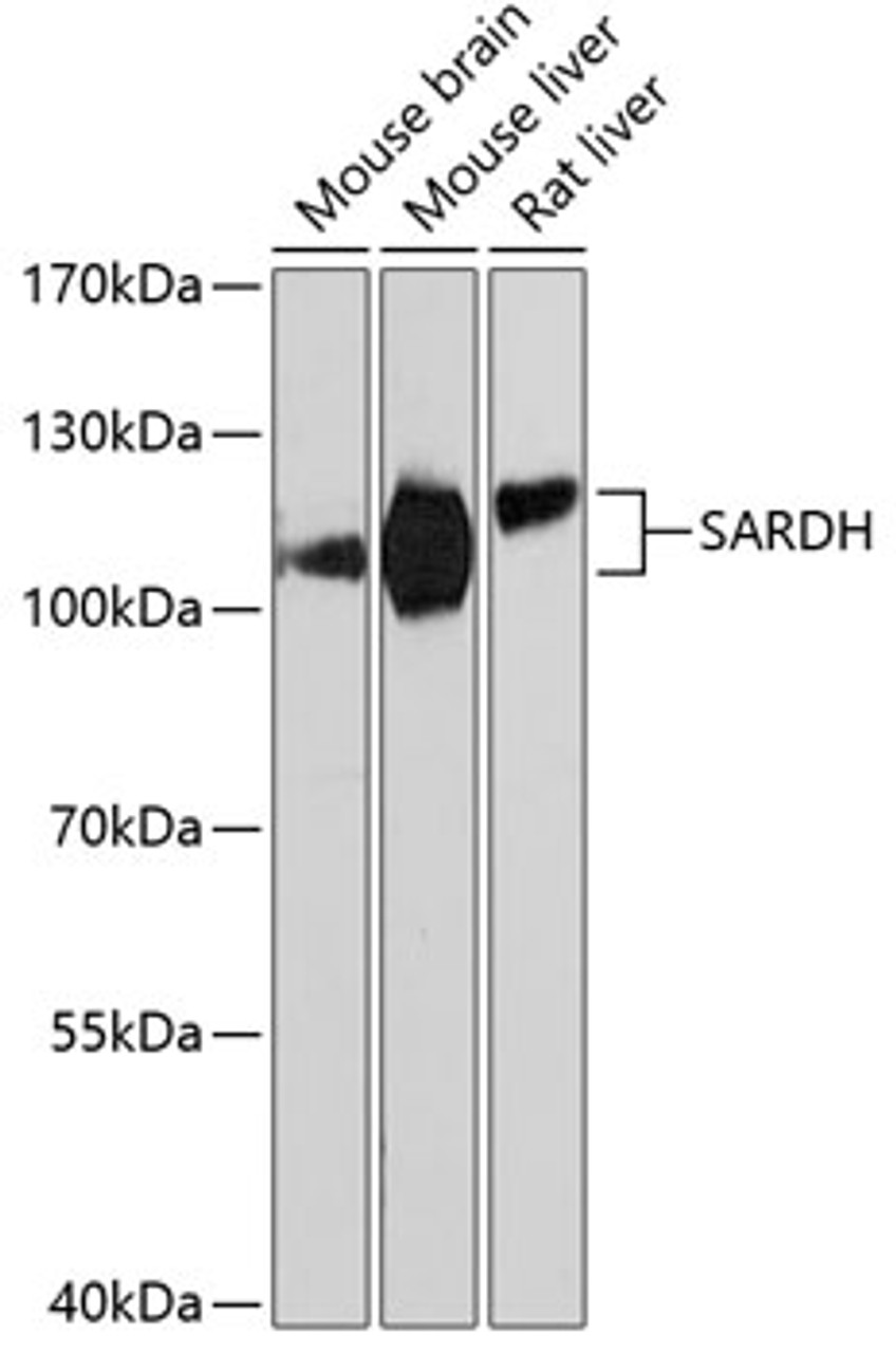 Western blot analysis of extracts of various cell lines using SARDH Polyclonal Antibody at dilution of 1:3000.