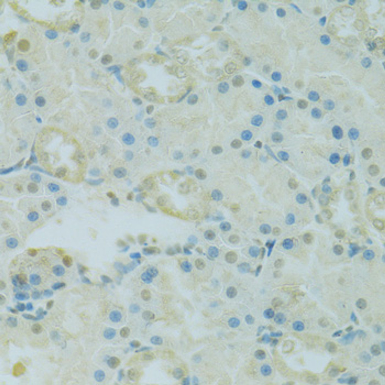 Immunohistochemistry of paraffin-embedded Rat kidney using PHOX2B Polyclonal Antibody at dilution of  1:100 (40x lens).