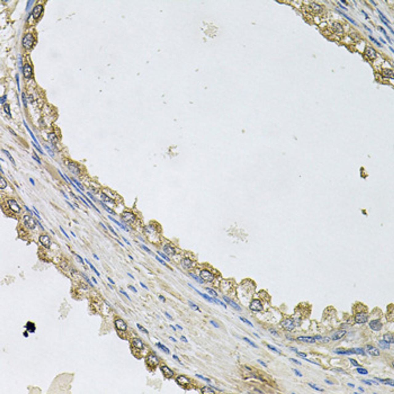 Immunohistochemistry of paraffin-embedded Human prostate using MTERFD1 Polyclonal Antibody at dilution of  1:100 (40x lens).