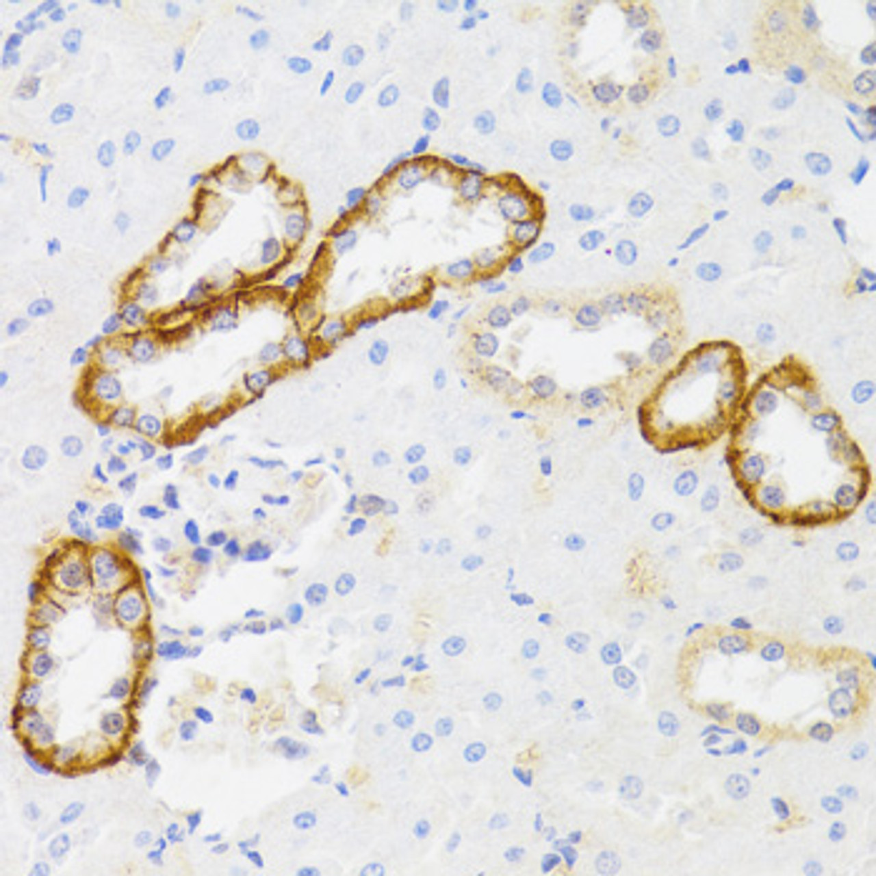 Immunohistochemistry of paraffin-embedded Rat kidney using MYO5A Polyclonal Antibody at dilution of  1:100 (40x lens).