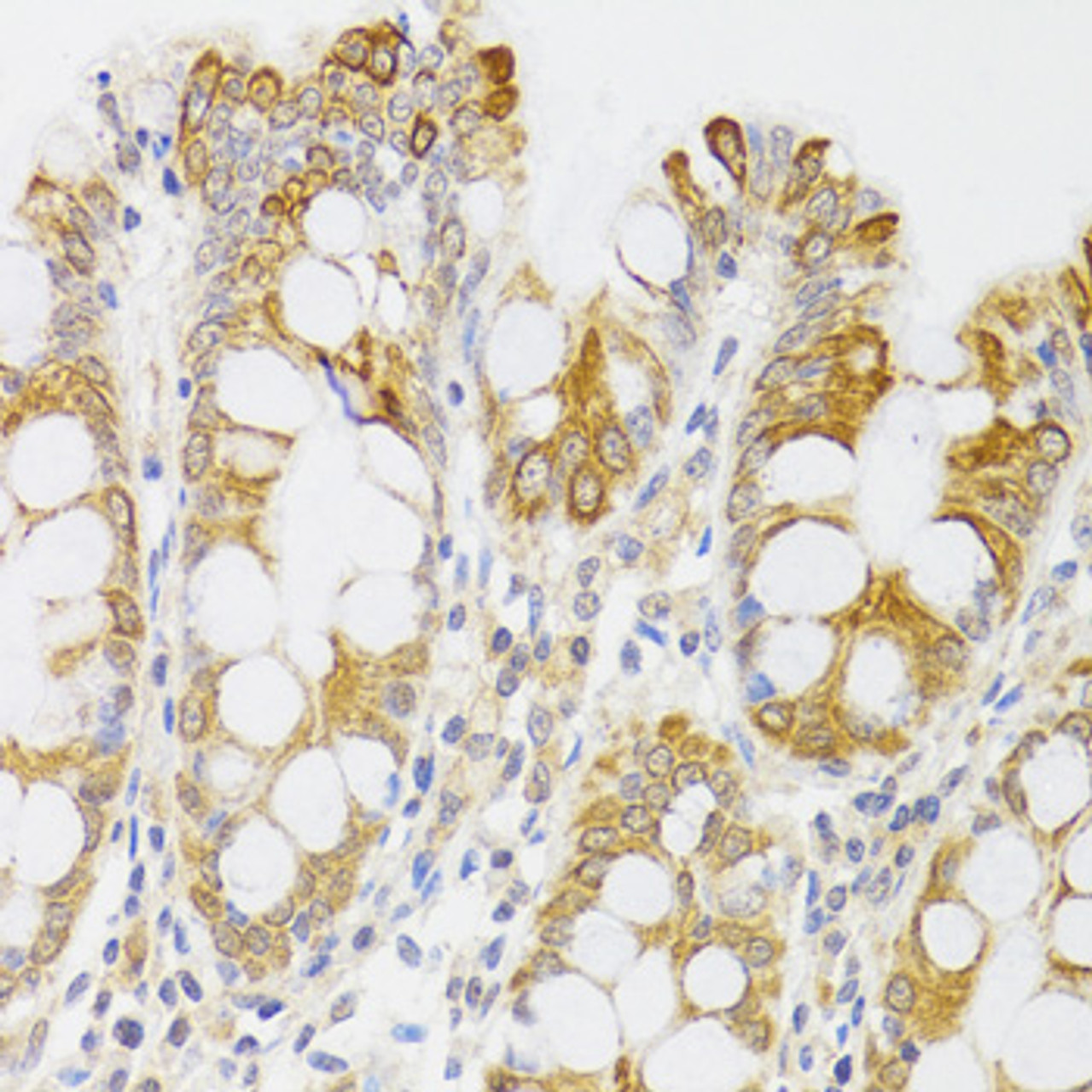 Immunohistochemistry of paraffin-embedded Human rectum using MYO5A Polyclonal Antibody at dilution of  1:100 (40x lens).