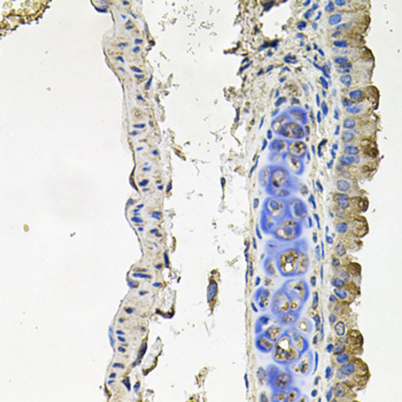 Immunohistochemistry of paraffin-embedded Mouse lung using NDUFA6 Polyclonal Antibody at dilution of  1:100 (40x lens).