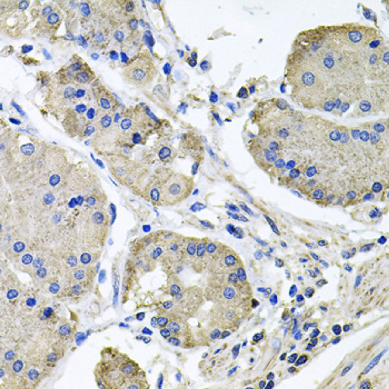 Immunohistochemistry of paraffin-embedded Human stomach using NDUFA6 Polyclonal Antibody at dilution of  1:100 (40x lens).