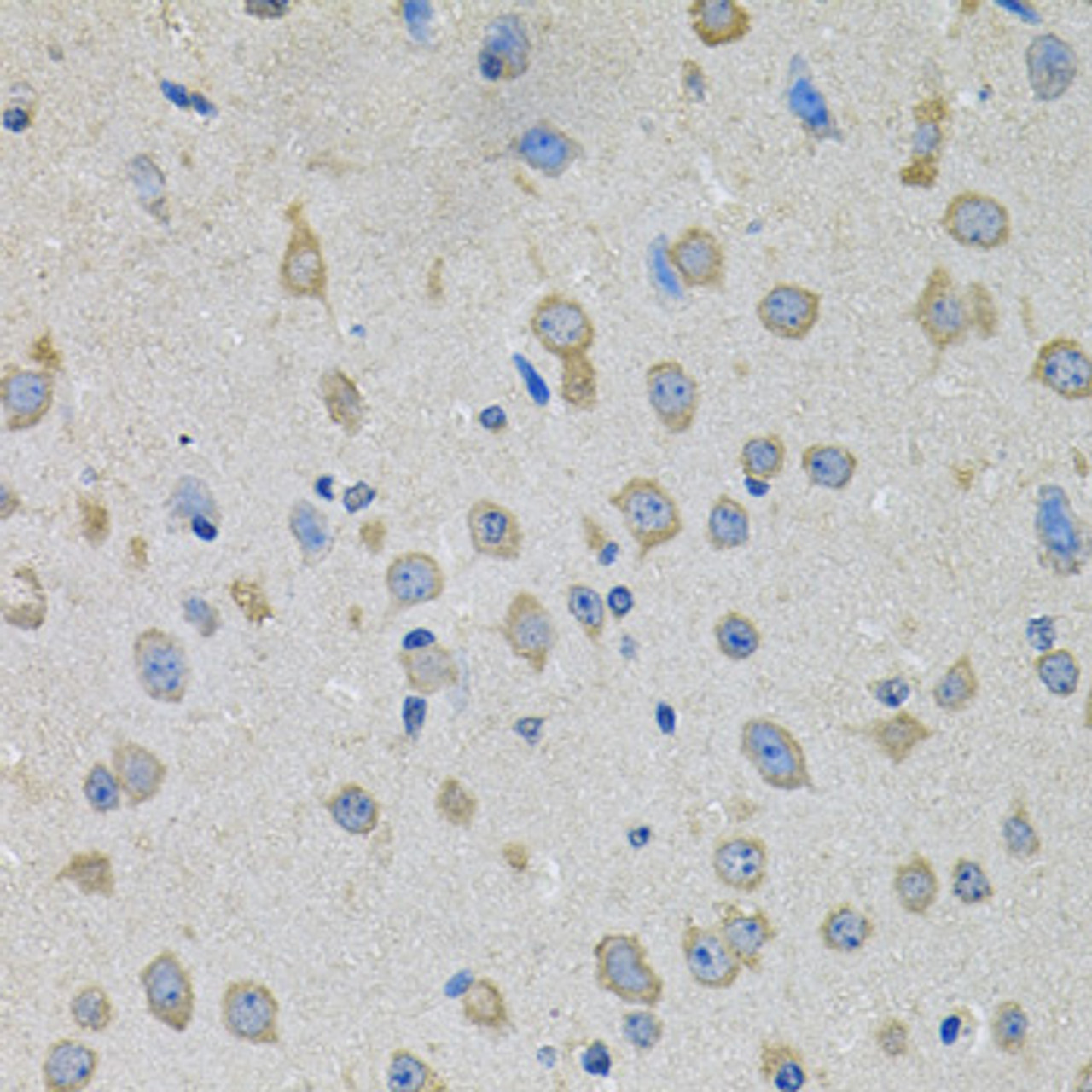 Immunohistochemistry of paraffin-embedded Mouse brain using PTK7 Polyclonal Antibody at dilution of  1:100 (40x lens).