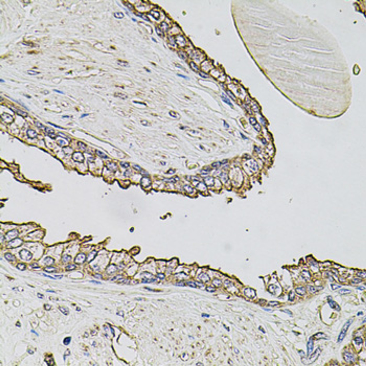 Immunohistochemistry of paraffin-embedded Human prostate using ABCC3 Polyclonal Antibody at dilution of  1:100 (40x lens).