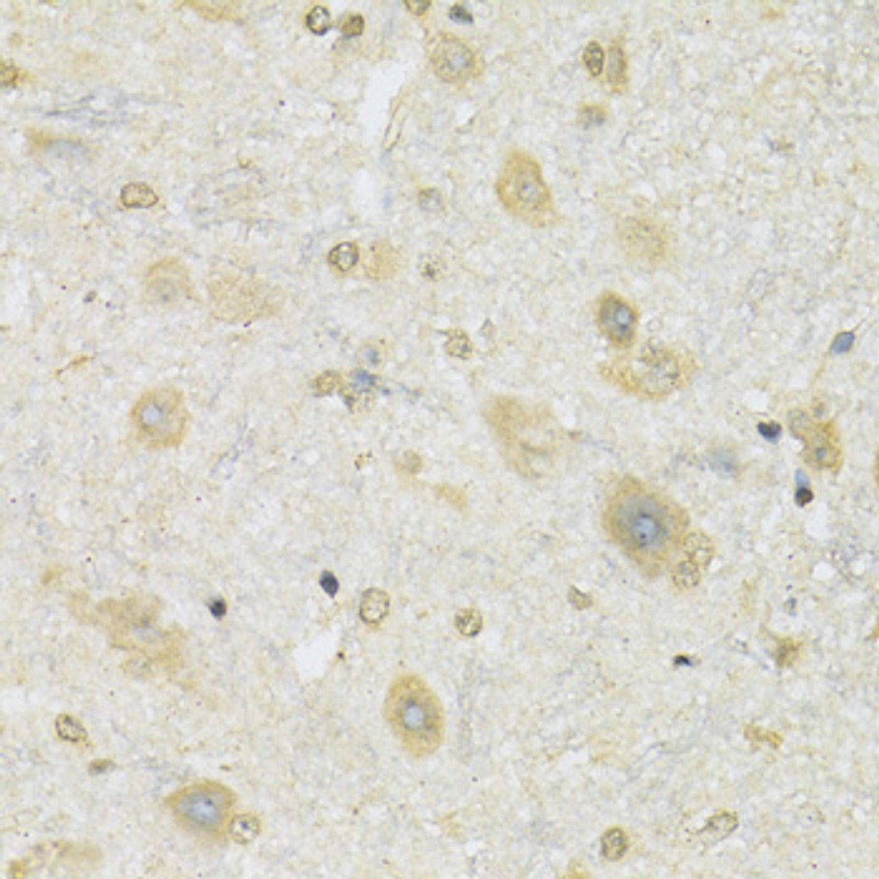 Immunohistochemistry of paraffin-embedded Mouse spinal cord using SLC2A13 Polyclonal Antibody at dilution of  1:100 (40x lens).