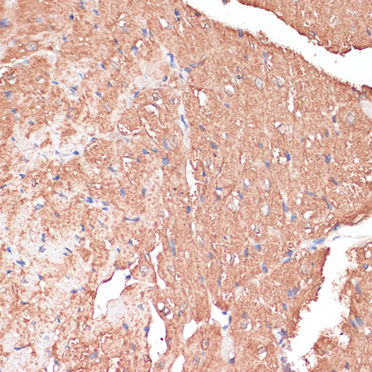 Immunohistochemistry of paraffin-embedded Mouse heart using FRMD6 Polyclonal Antibody at dilution of  1:100 (40x lens).