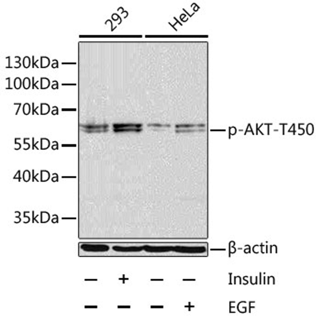 Western blot analysis of extracts of 293 and HeLa cells using Phospho-AKT(T450) Polyclonal Antibody at dilution of 1:1000. 293 cells were treated by Insulin (100nM) for 10 minutes after serum-starvation overnight. HeLa cells were treated by EGF (100ng/ml) for 30 minutes after serum-starvation overnight.