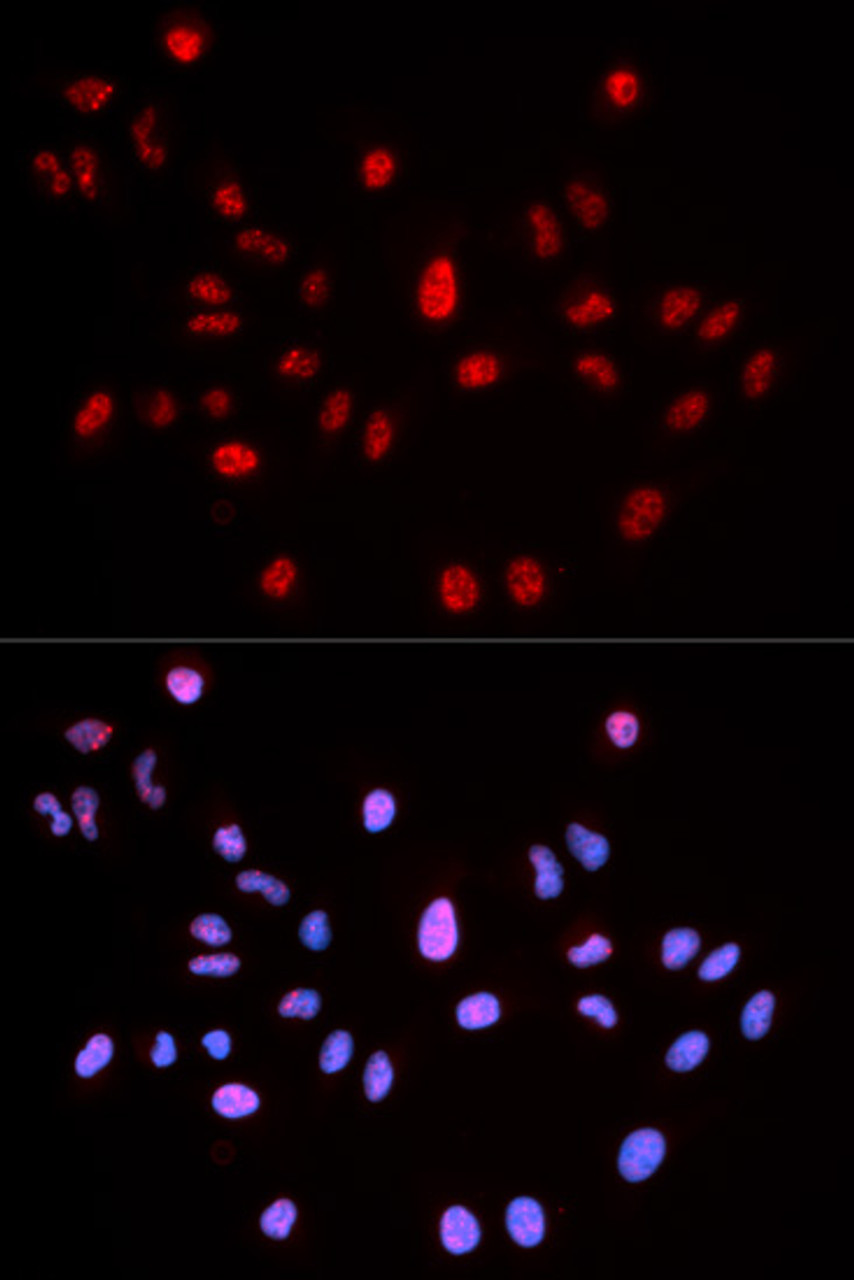 Immunofluorescence analysis of MCF-7 cells using Phospho-ATM(S1981) Polyclonal Antibody