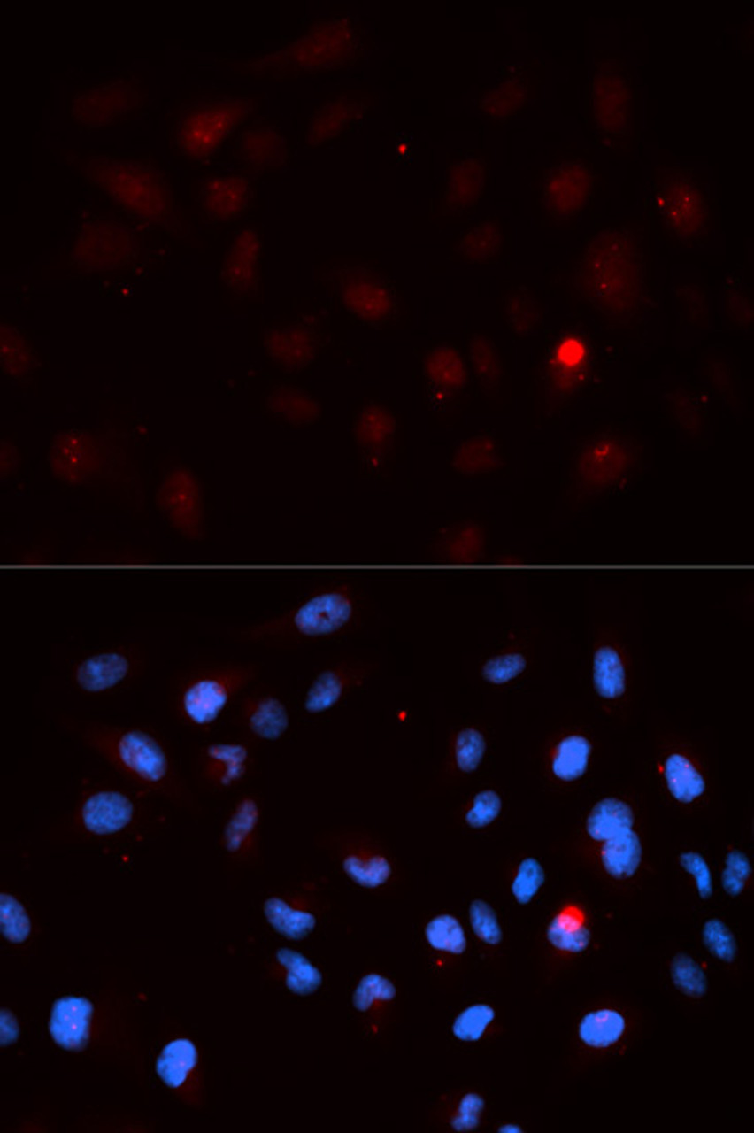 Immunofluorescence analysis of MCF-7 cells using Phospho-CDK1(T14) Polyclonal Antibody