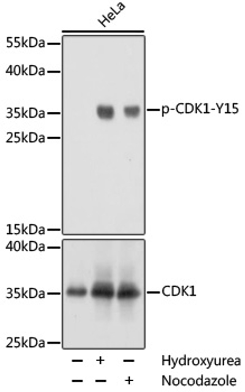 Western blot analysis of extracts of NIH/3T3 cells using Phospho-CDK1(Y15) Polyclonal Antibody at dilution of 1:1000.