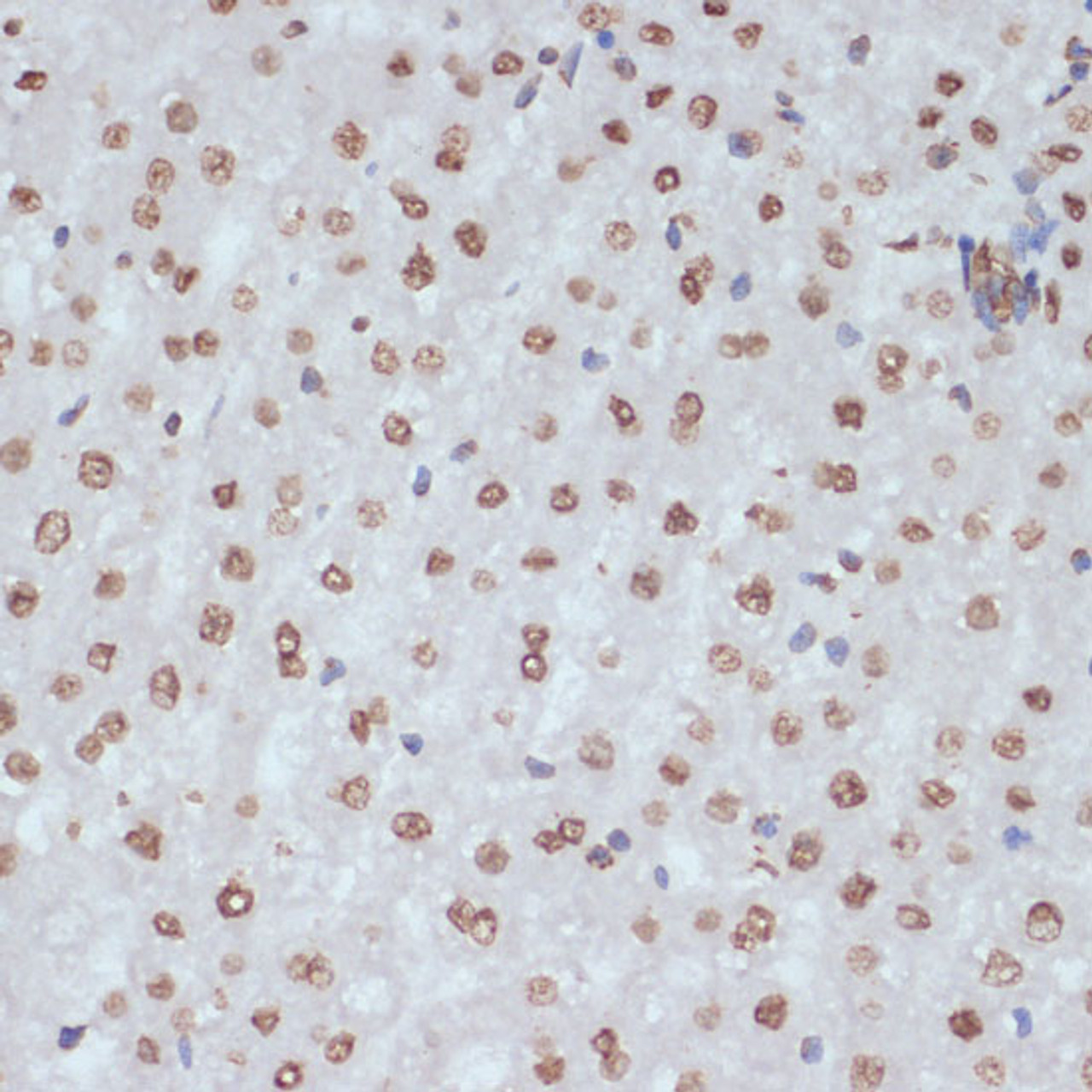 Immunohistochemistry of paraffin-embedded Rat liver using Phospho-CDK1(Y15) Polyclonal Antibody at dilution of  1:100 (40x lens).