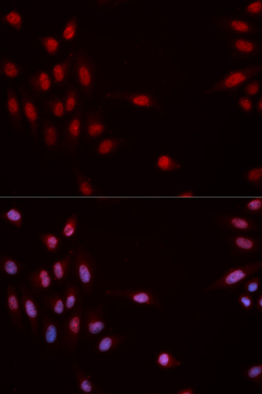 Immunofluorescence analysis of MCF-7 cells using Phospho-CHEK1(S317) Polyclonal Antibody