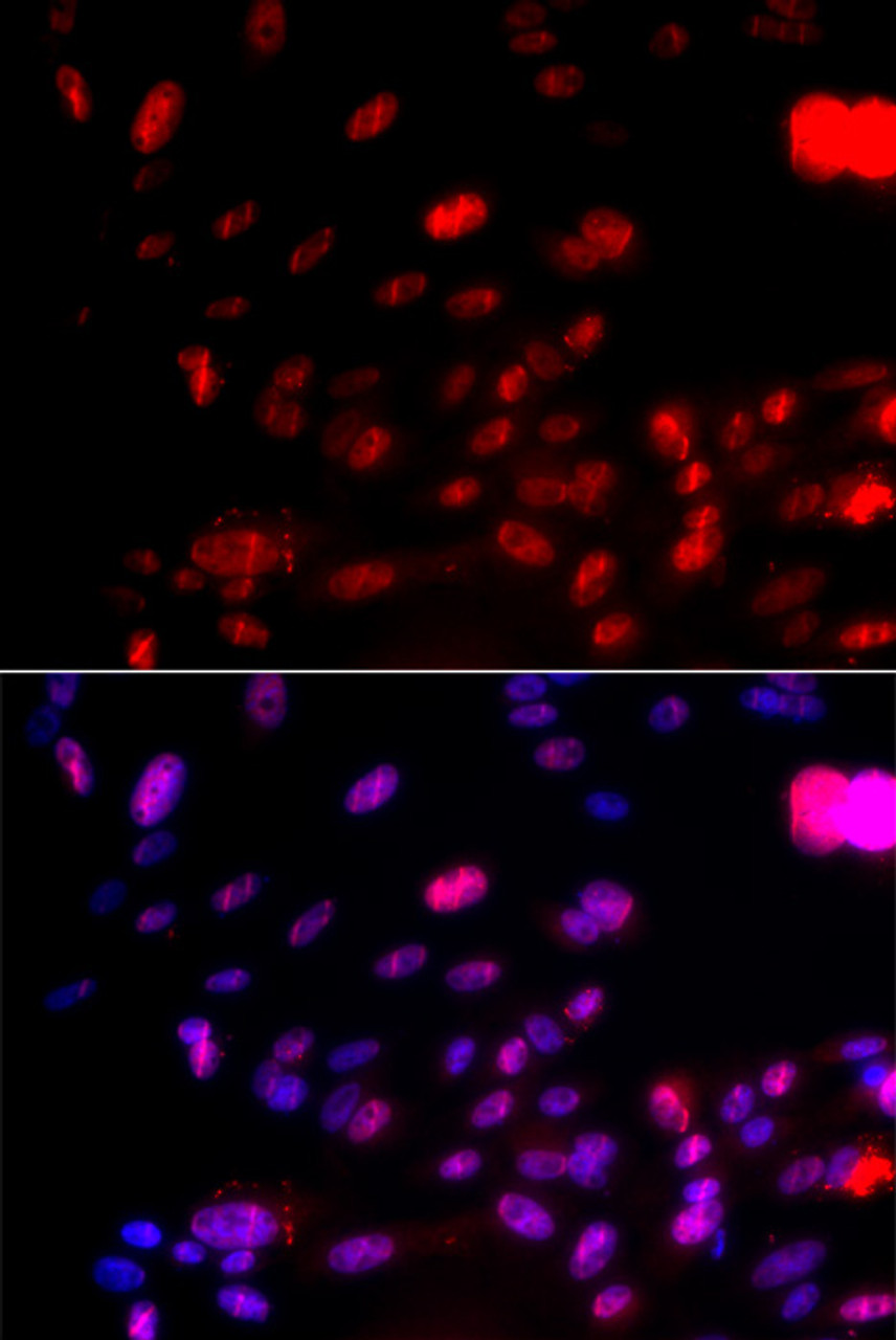 Immunofluorescence analysis of U2OS cells using Phospho-CHEK1(S317) Polyclonal Antibody