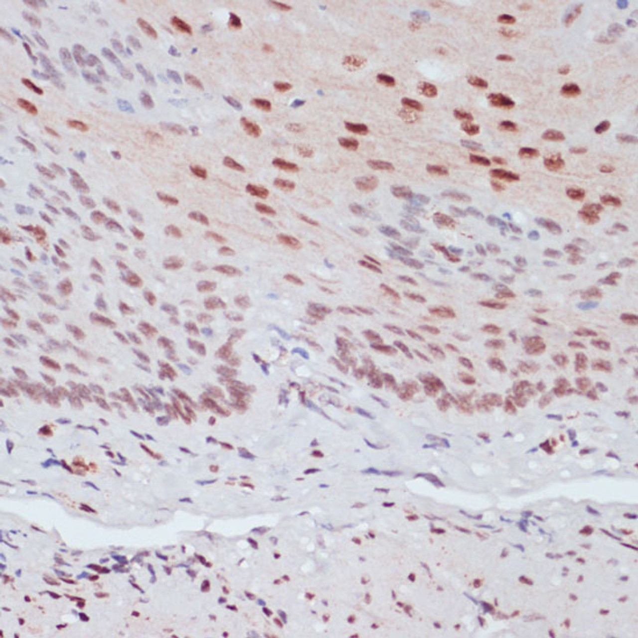 Immunohistochemistry of paraffin-embedded Human esophageal using Phospho-CREB1(S133) Polyclonal Antibody at dilution of  1:100 (40x lens).
