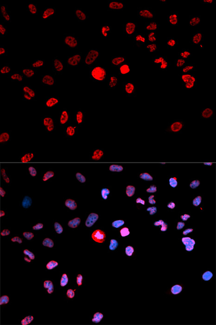 Immunofluorescence analysis of MCF-7 cells using Phospho-CREB1(S133) Polyclonal Antibody