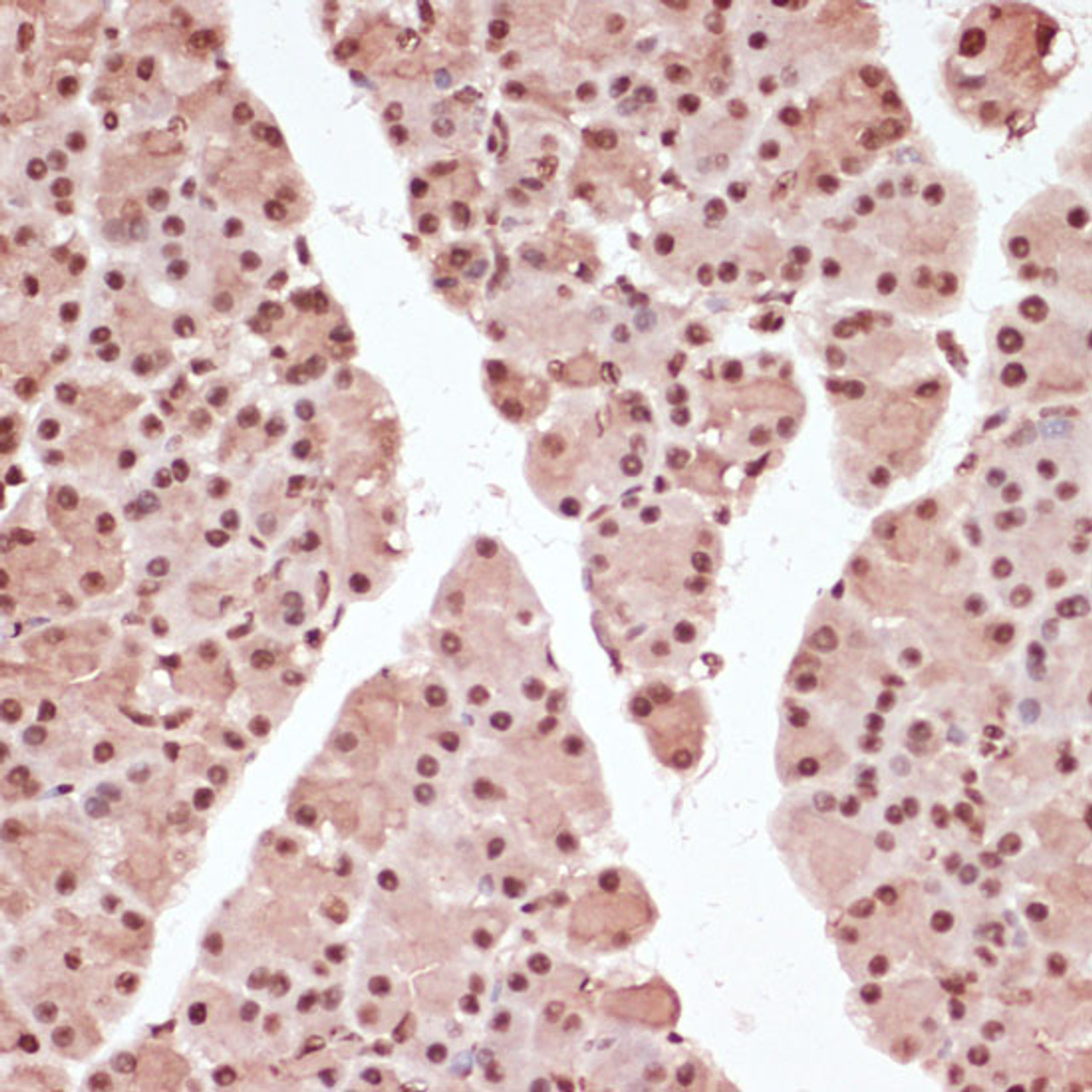 Immunohistochemistry of paraffin-embedded Rat pancreas using Phospho-ATF2(T71) Polyclonal Antibody at dilution of  1:100 (40x lens).