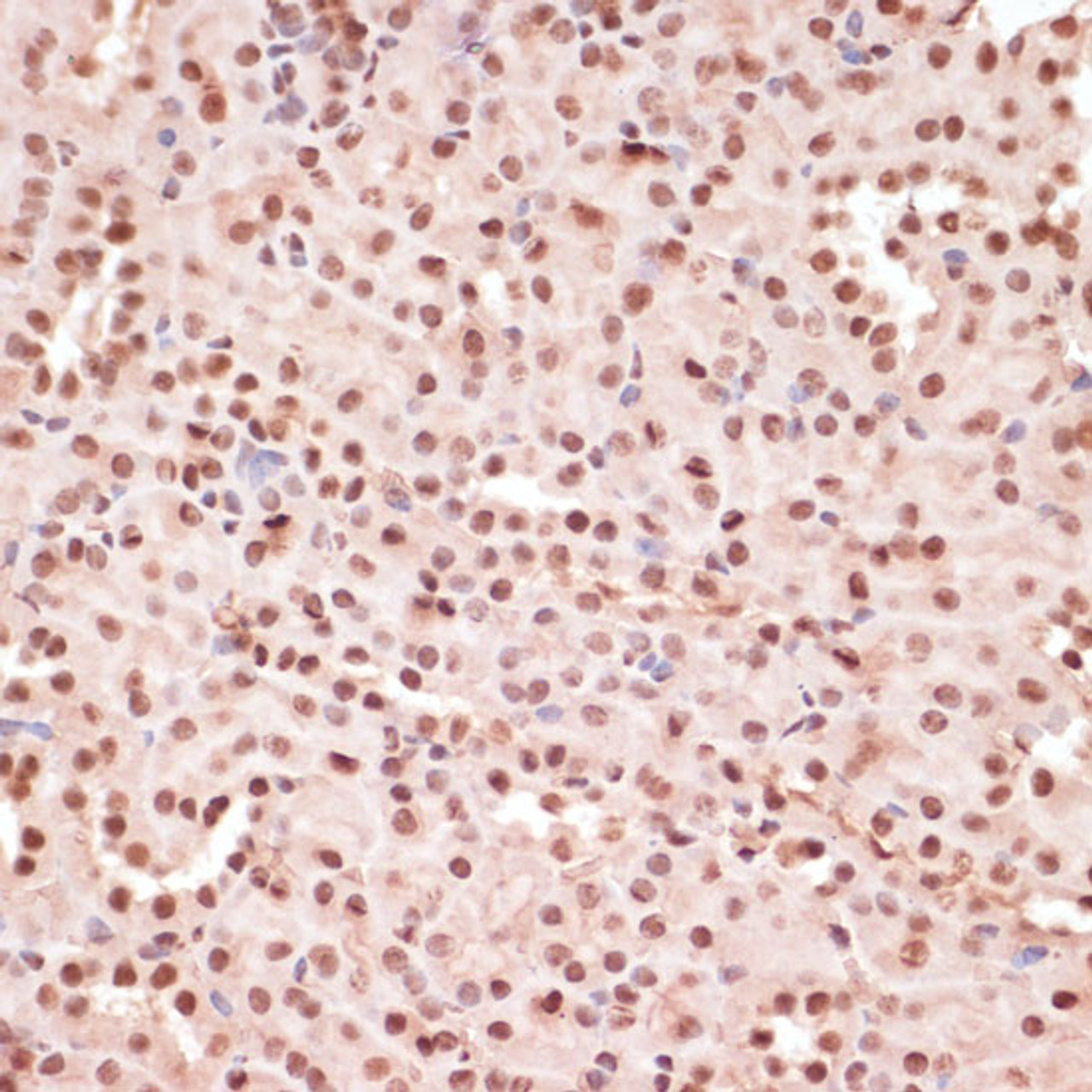 Immunohistochemistry of paraffin-embedded Mouse kidney using Phospho-ATF2(T71) Polyclonal Antibody at dilution of  1:100 (40x lens).