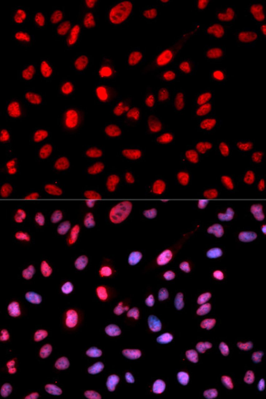 Immunofluorescence analysis of MCF-7 cells using Phospho-Dnmt1(pS714) Polyclonal Antibody