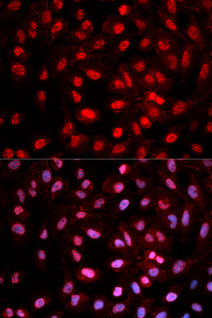 Immunofluorescence analysis of MCF-7 cells using Phospho-Dnmt1(pY399) Polyclonal Antibody