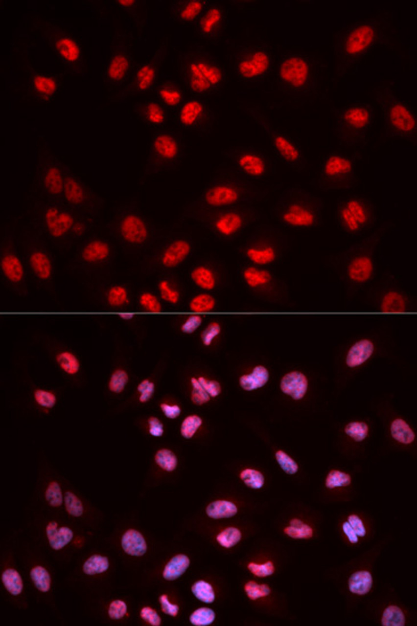 Immunofluorescence analysis of MCF-7 cells using Phospho-ELK1(S383) Polyclonal Antibody