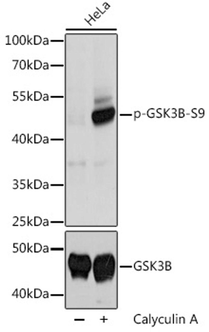 Western blot analysis of extracts of HeLa cells using Phospho-GSK3B(S9) Polyclonal Antibody at dilution of 1:2000.