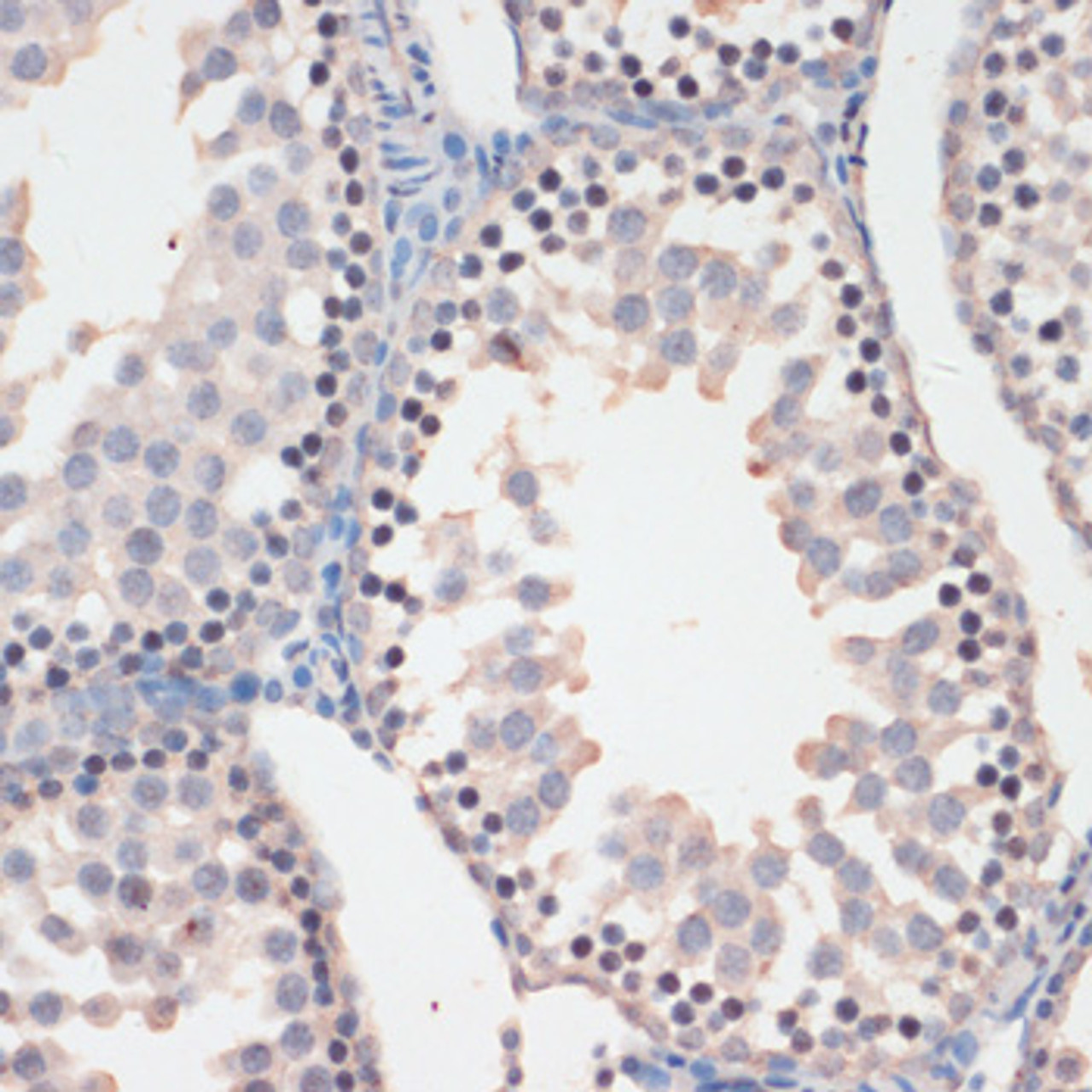 Immunohistochemistry of paraffin-embedded Mouse testis using Phospho-GSK3B(S9) Polyclonal Antibody at dilution of  1:100 (40x lens).