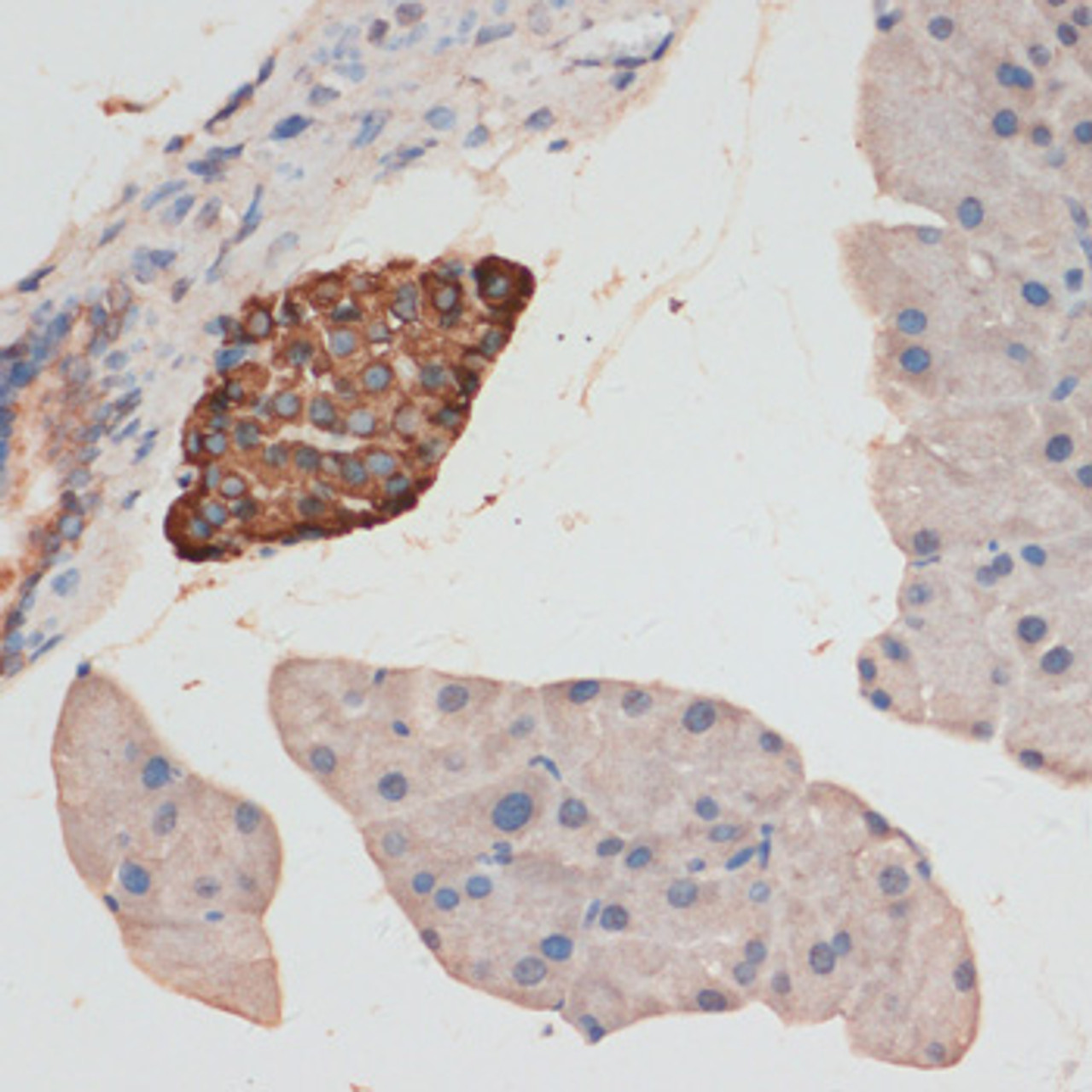 Immunohistochemistry of paraffin-embedded Mouse pancreas using Phospho-GSK3B(S9) Polyclonal Antibody at dilution of  1:100 (40x lens).
