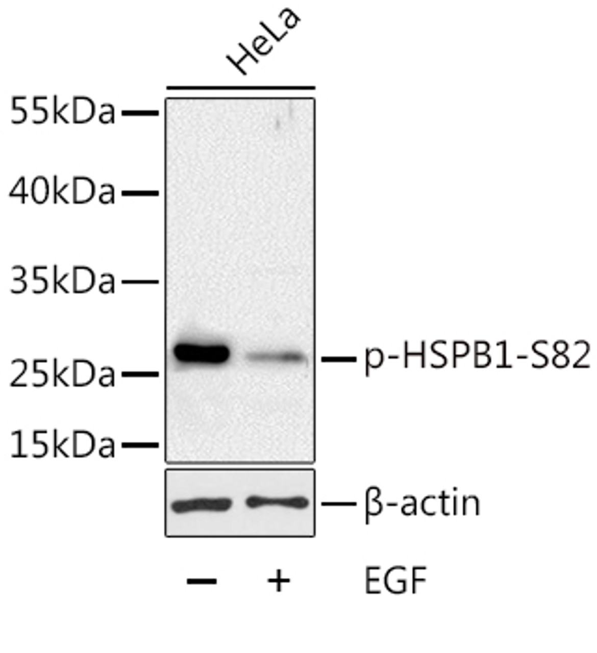Western blot analysis of extracts of HeLa cells using Phospho-HSPB1(S82) Polyclonal Antibody at dilution of 1:1000. HeLa cells were treated by EGF (100ng/ml) for 30 minutes after serum-starvation overnight.
