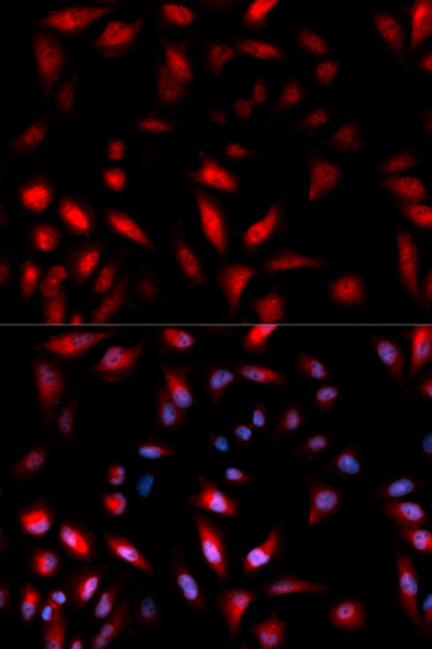 Immunofluorescence analysis of U2OS cells using Phospho-HSPB1(S82) Polyclonal Antibody