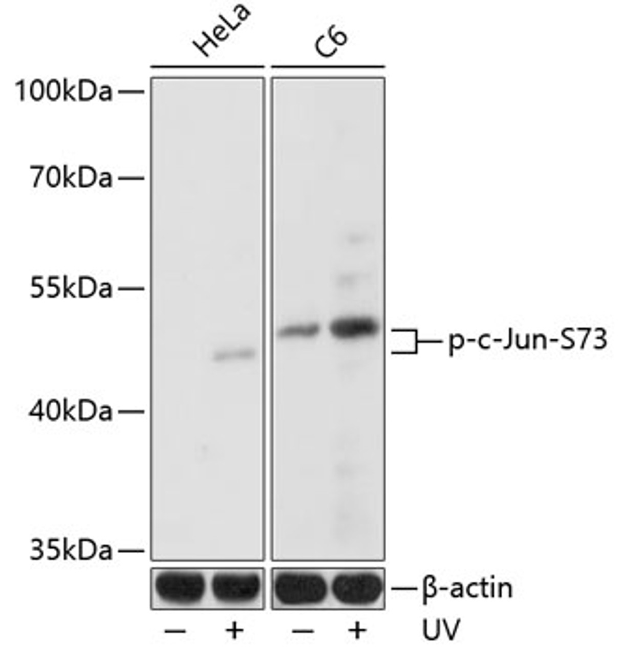 Western blot analysis of extracts of various cell lines using Phospho-c-Jun(S73) Polyclonal Antibody at dilution of 1:1000. HeLa cells were treated by UV at room tempeRature for 15-30 minutes. C6 cells were treated by UV at room tempeRature for 15-30 minutes.