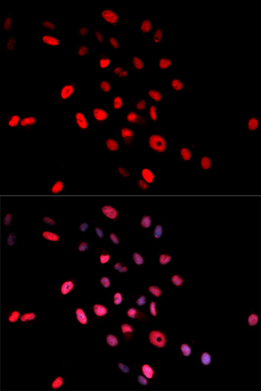 Immunofluorescence analysis of MCF-7 cells using Phospho-c-Jun(S63) Polyclonal Antibody