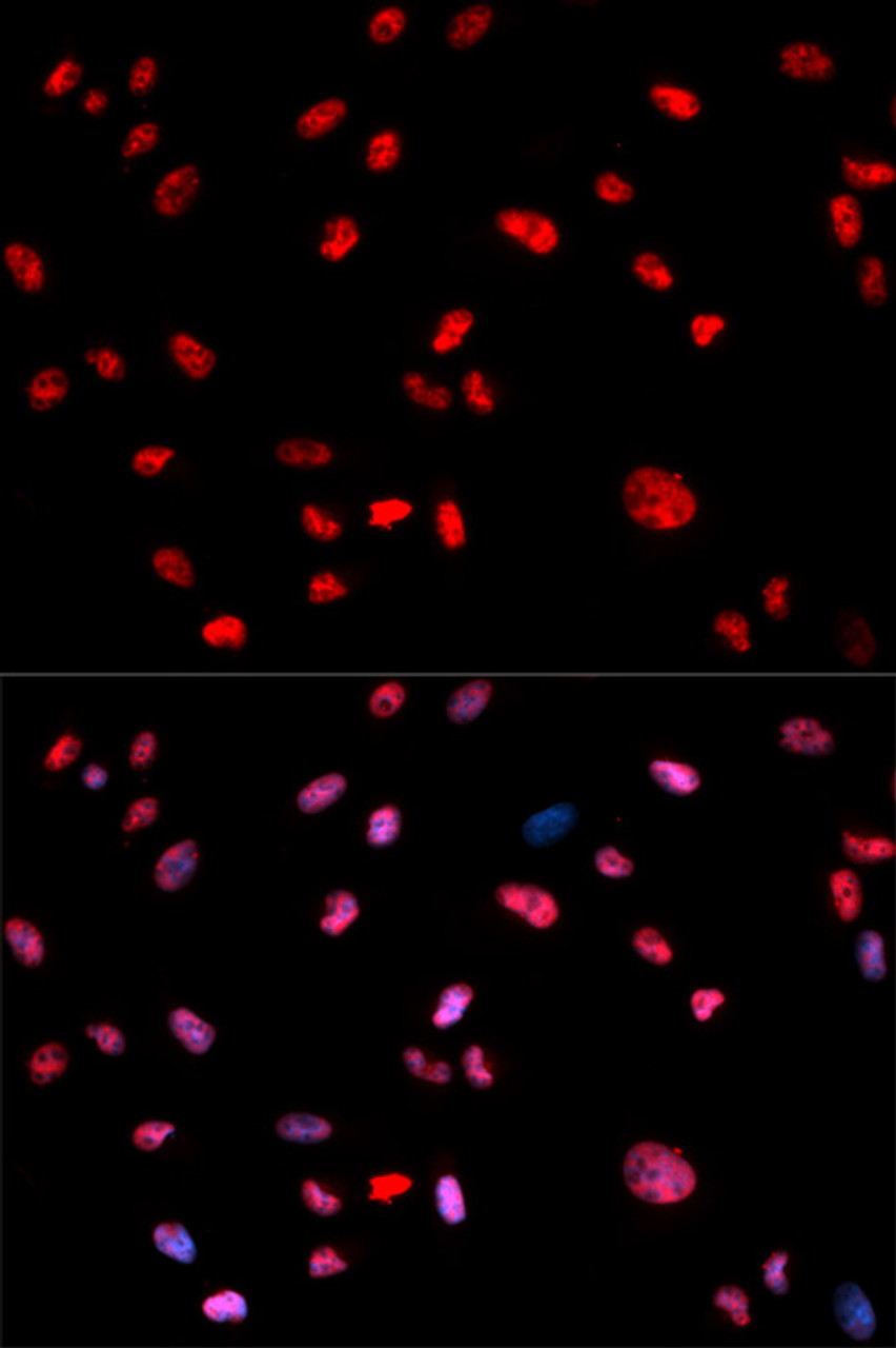 Immunofluorescence analysis of U2OS cells using Phospho-Jun(T239) Polyclonal Antibody