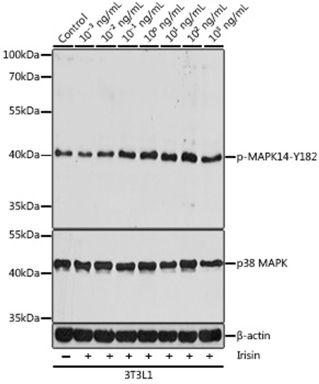 Western blot analysis of extracts of 3T3L1 cells using Phospho-MAPK14(Y182) Polyclonal Antibody at dilution of 1:1000.