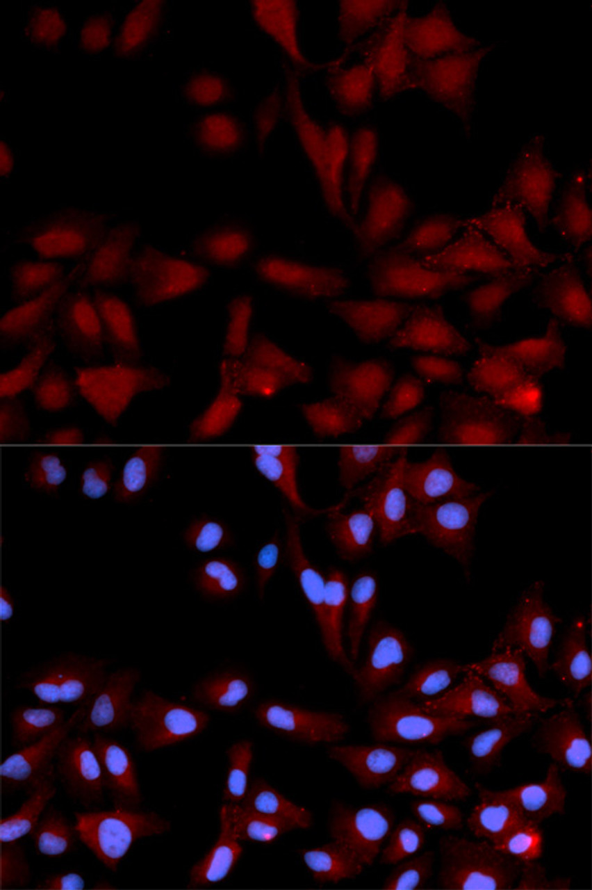 Immunofluorescence analysis of U2OS cells using Phospho-MAPK14(Y182) Polyclonal Antibody