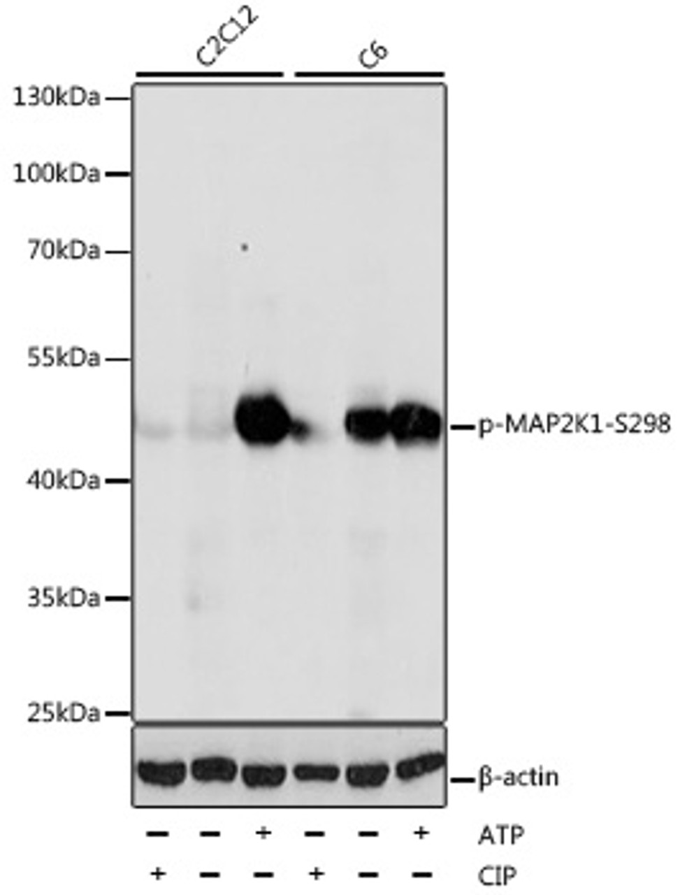 Western blot analysis of extracts of various cell lines using Phospho-MAP2K1(S298) Polyclonal Antibody at dilution of 1:1000. C2C12 cells were treated by CIP(20uL/400ul) at 37°C for 1 hour or treated by ATP(5 mM) at 30°C for 1 hour. C6 cells were treated by CIP(20uL/400ul) at 37°C for 1 hour or treated by ATP(5 mM) at 30°C for 1 hour.