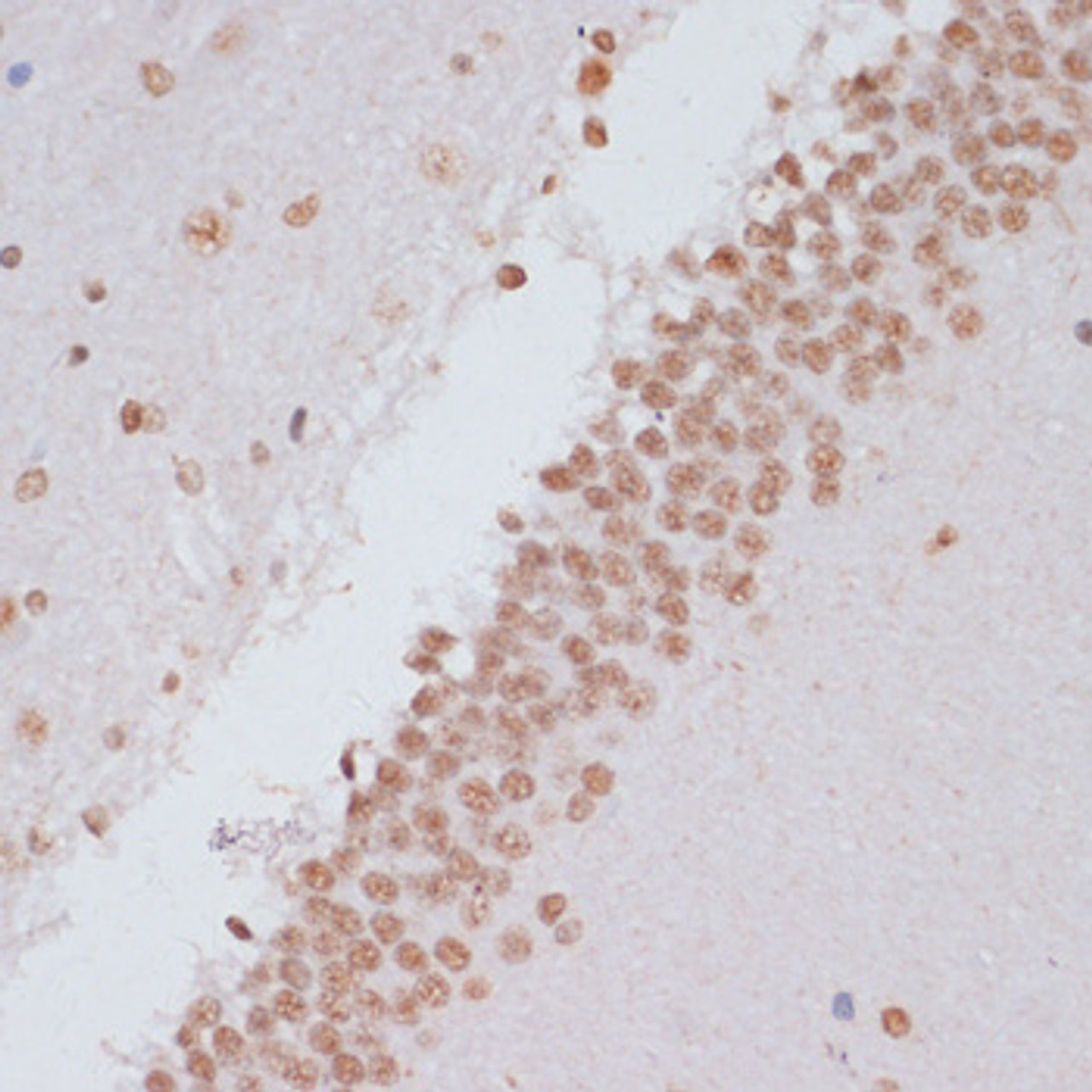 Immunohistochemistry of paraffin-embedded Rat brain using Phospho-Stat3(Y705) Polyclonal Antibody at dilution of  1:100 (40x lens).