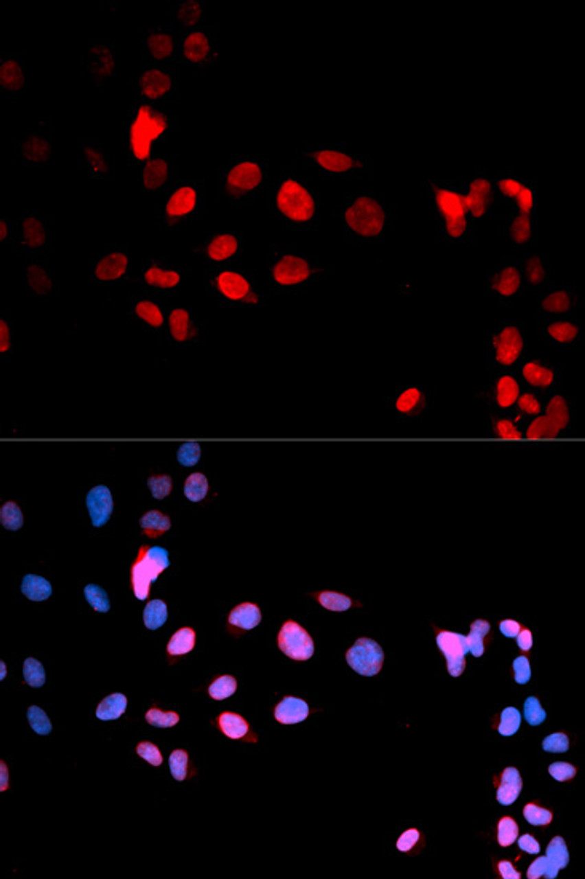 Immunofluorescence analysis of U2OS cells using Phospho-MAX(S11) Polyclonal Antibody