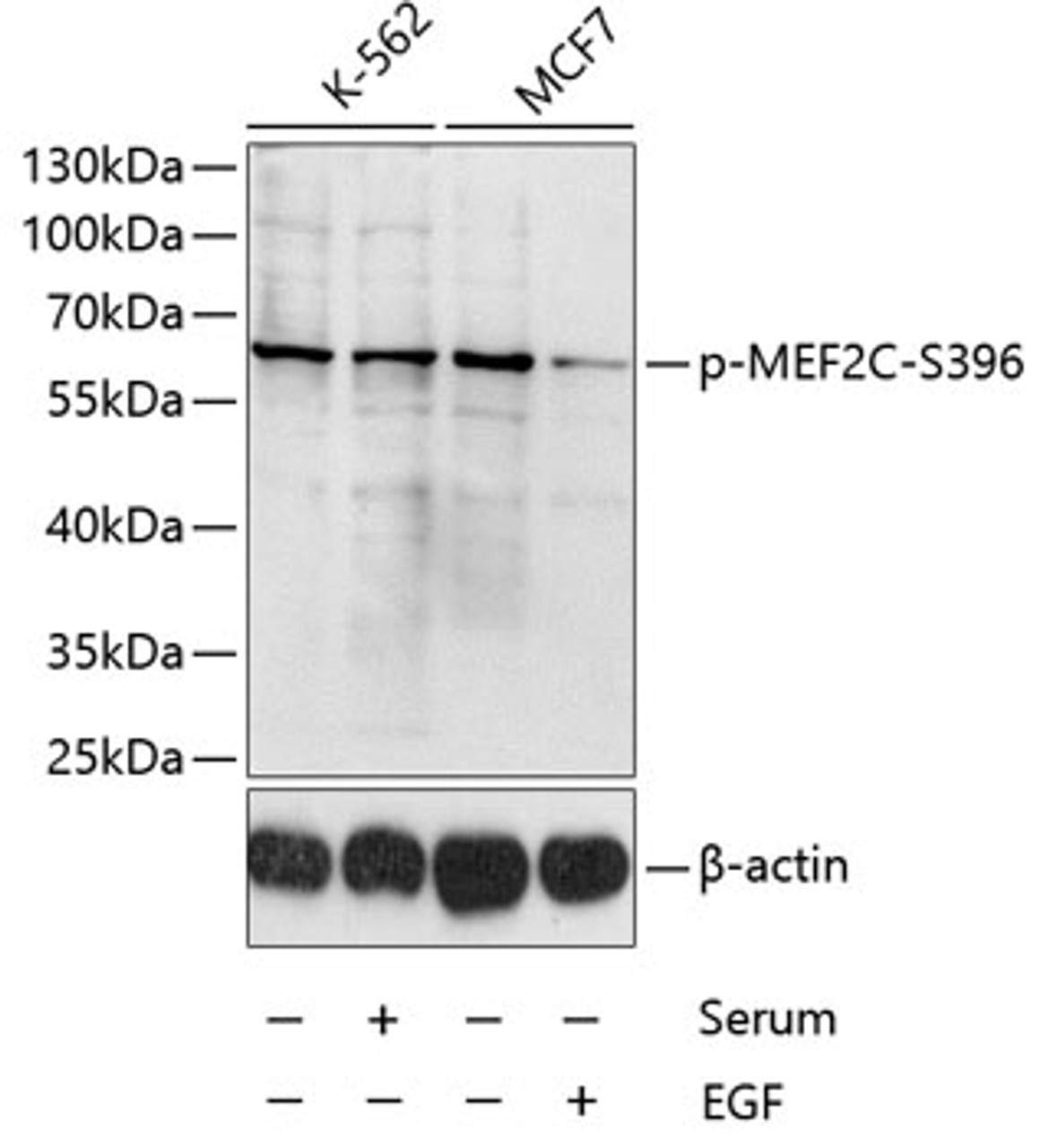 Western blot analysis of extracts of K-562 and MCF-7 cells using Phospho-MEF2C(S396) Polyclonal Antibody at dilution of 1:1000. K562 cells were treated by 10% FBS for 30 minutes after serum-starvation overnight. MCF7 cells were treated by EGF (100ng/ml) for 30 minutes after serum-starvation overnight.