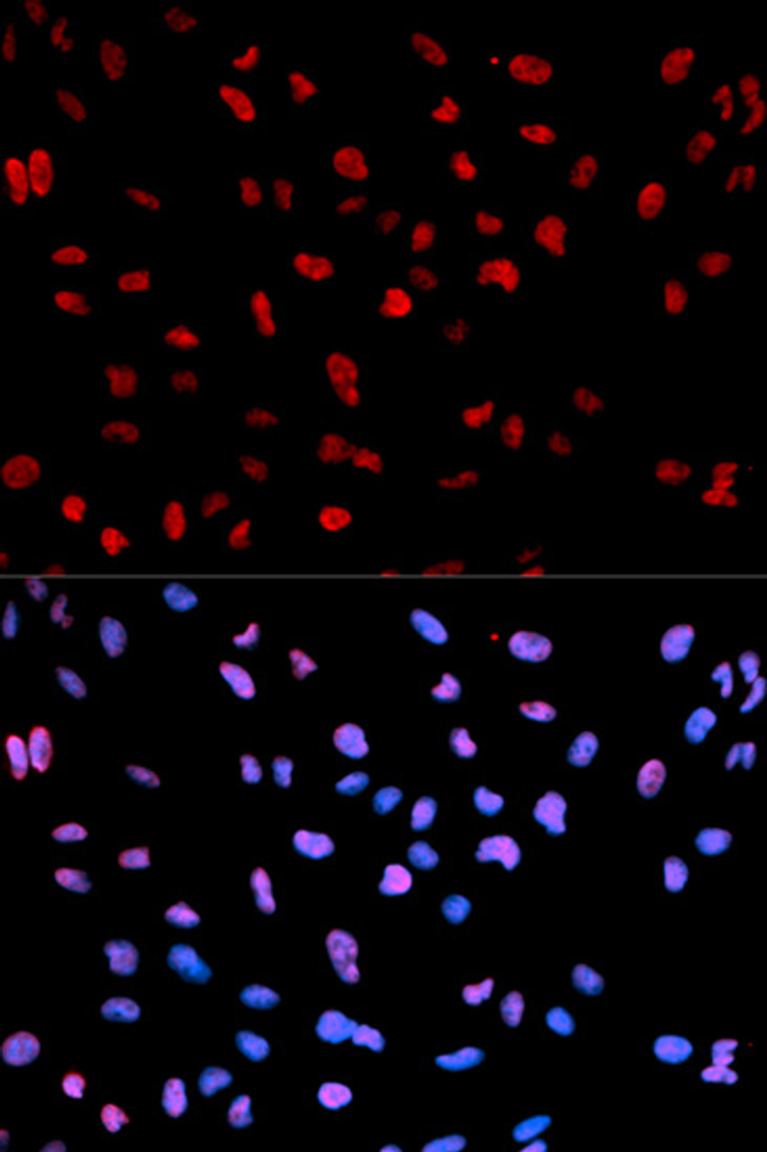 Immunofluorescence analysis of U2OS cells using Phospho-MEF2C(S396) Polyclonal Antibody